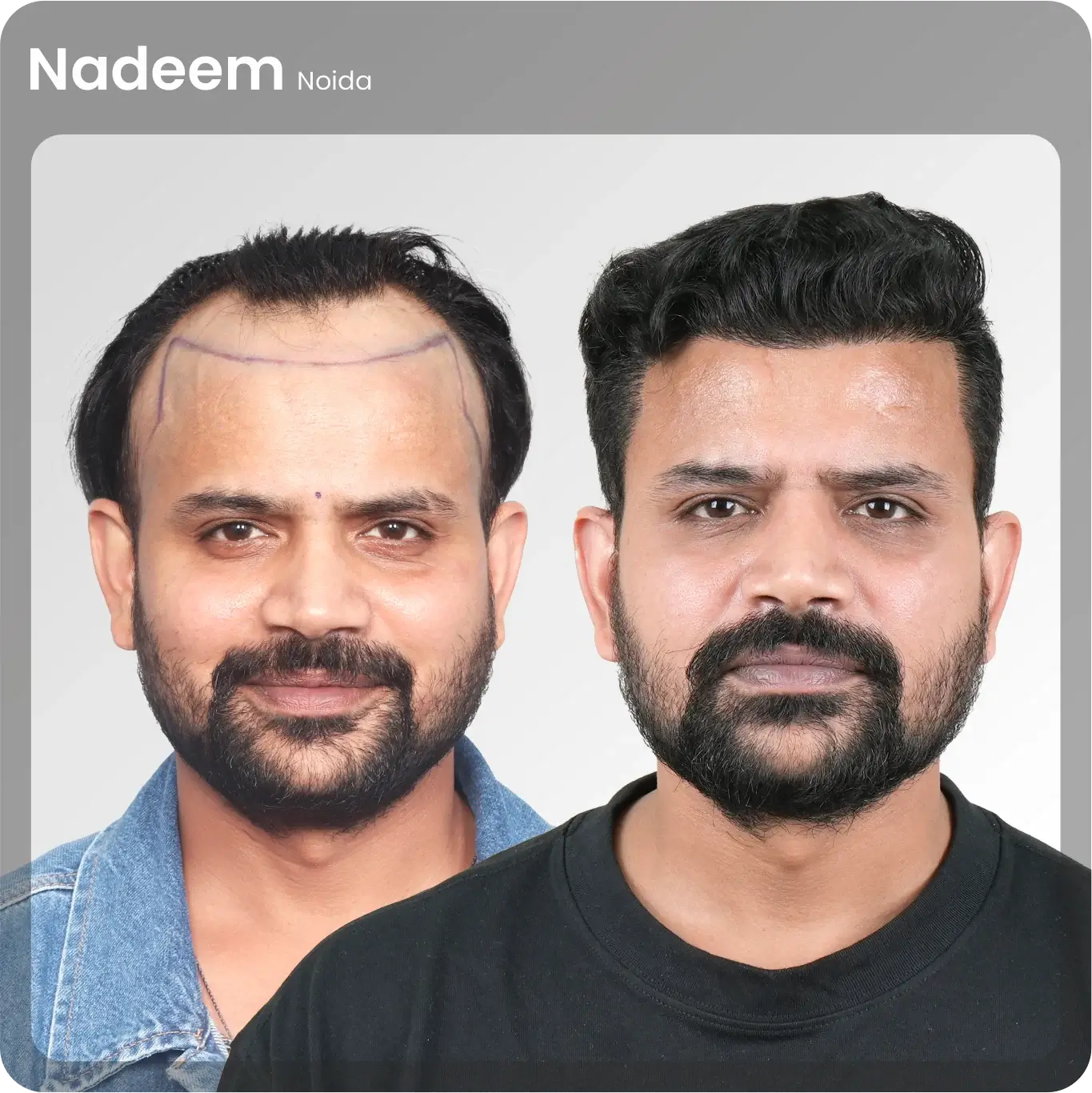 Nadeem.webp