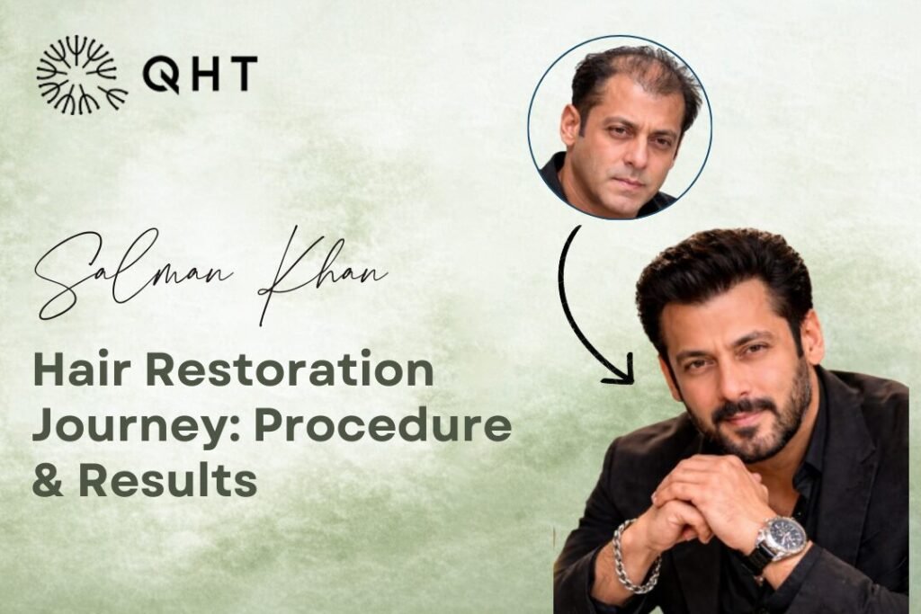 salman khan hair transplant
