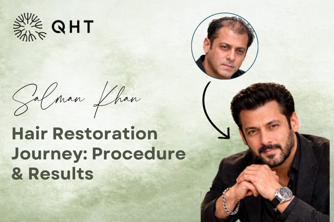 Salman Khan Hair Restoration Journey