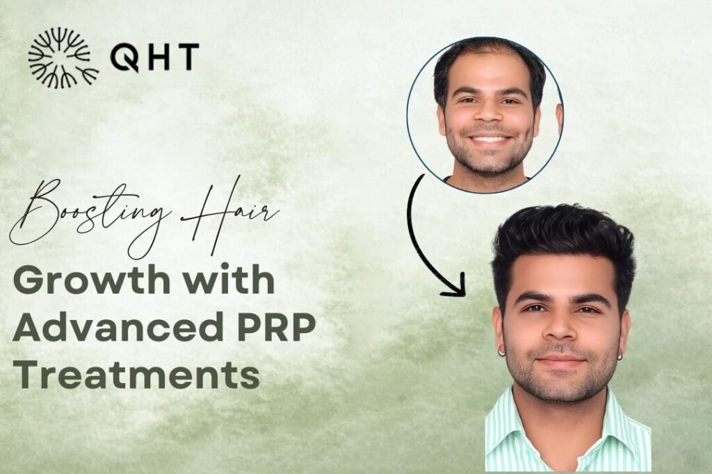 prp for hair restoration