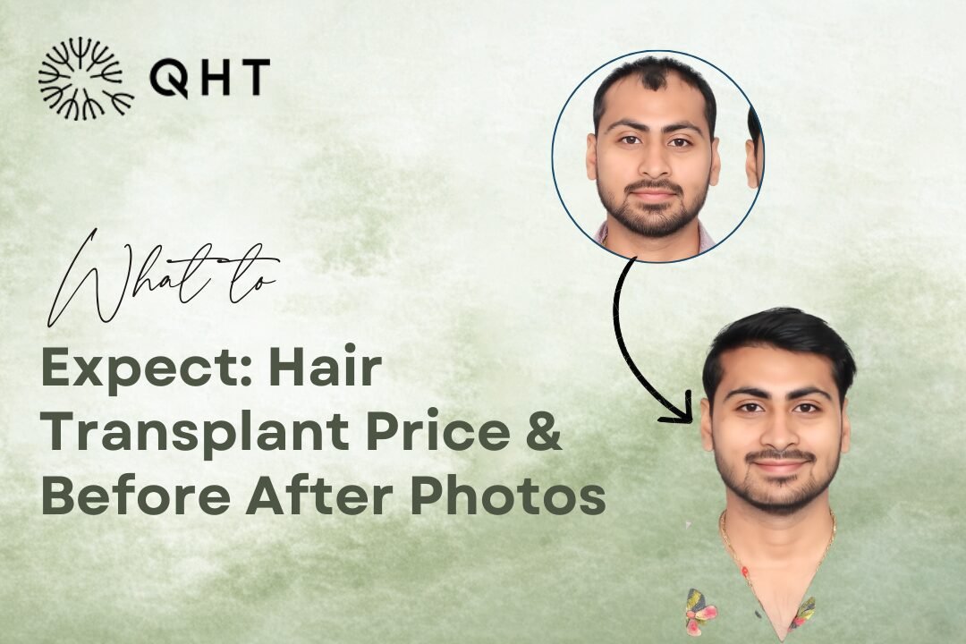 Hair Transplant Cost & Results