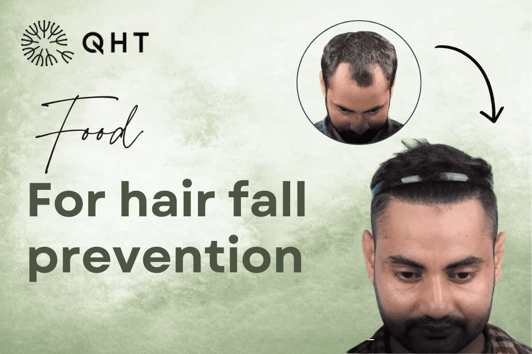Food for hair fall prevention