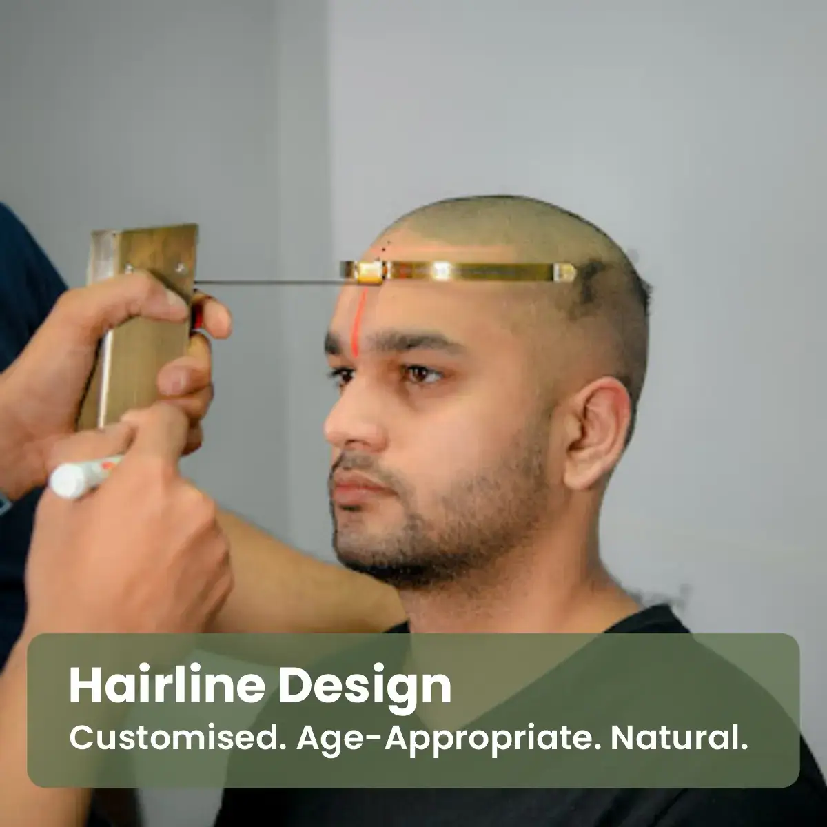 Hairline-design
