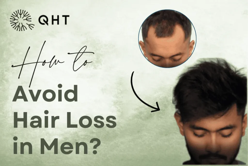 How to Avoid Hair Loss in Men