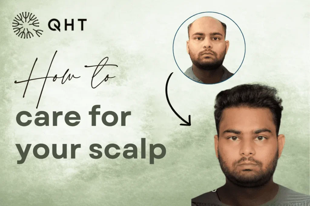 How to care for your scalp