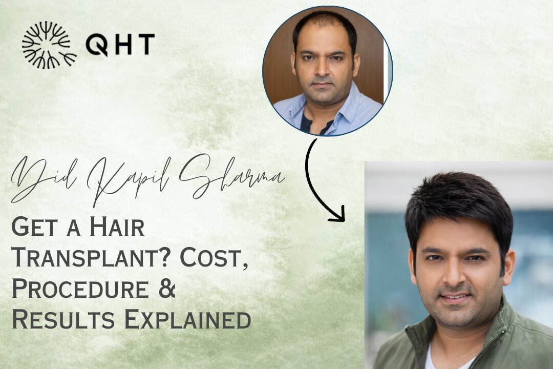 Kapil Sharma Hair Transplant: Cost, Procedure & Results