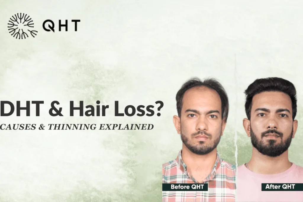 DHT hair loss