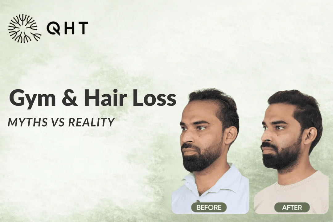Can Gym Workouts Trigger Hair Loss? Myths vs Reality