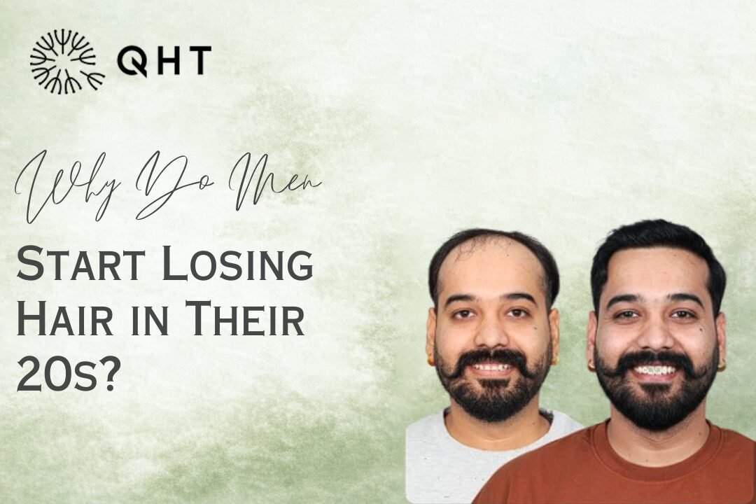 Male Pattern Baldness Treatment Options