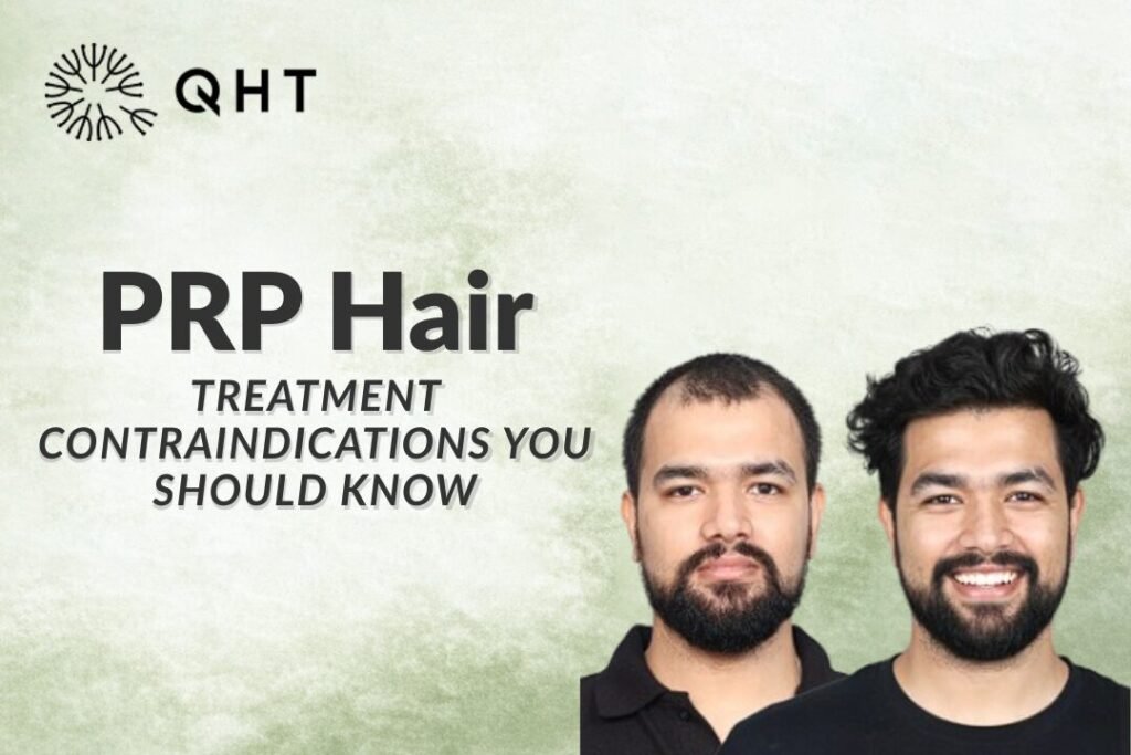 PRP Hair Treatment Contraindications You Should Know