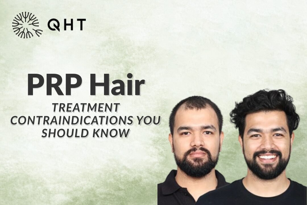 PRP Hair Treatment Contraindications You Should Know