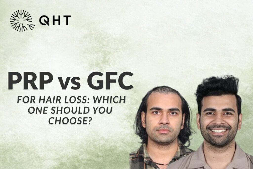 PRP vs GFC Hair Treatment for Hair Loss