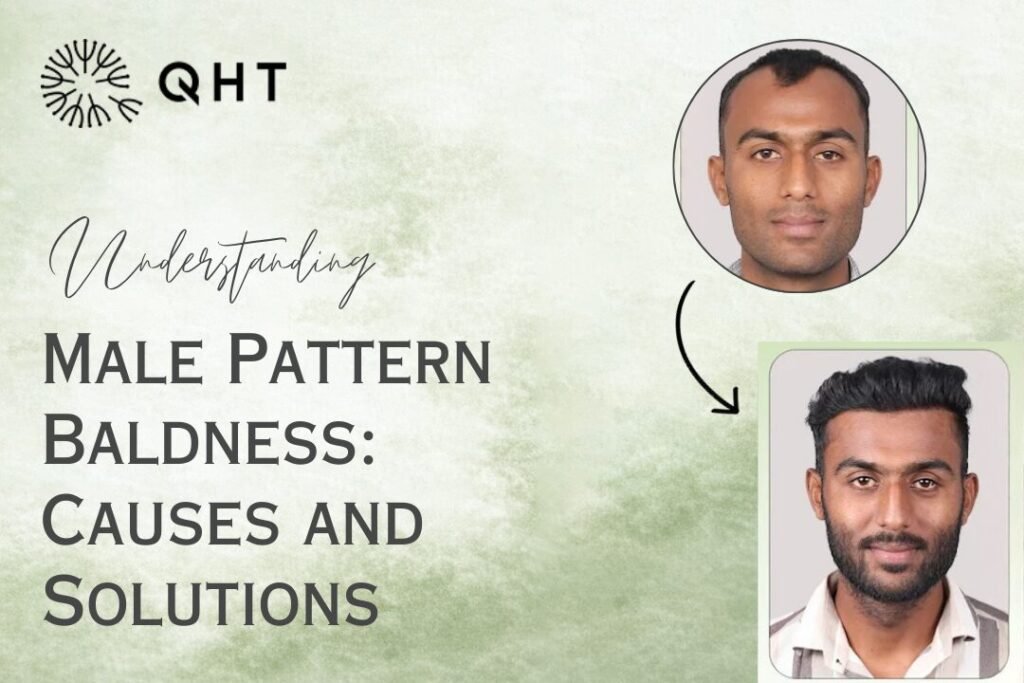 male pattern baldness