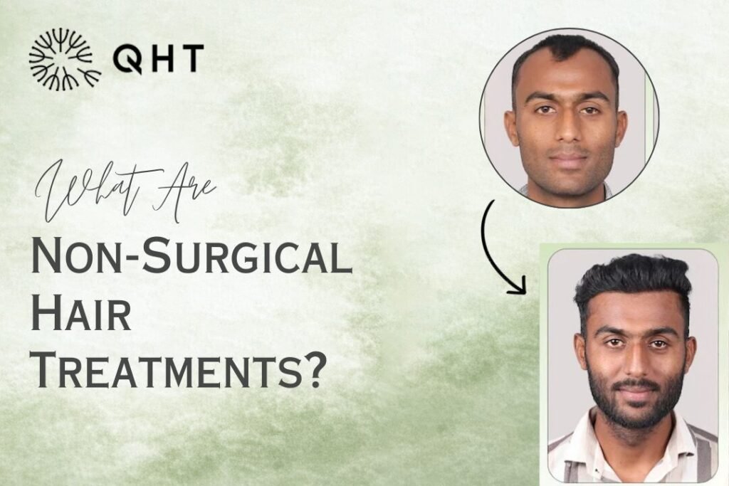 non surgical hair regrowth treatment