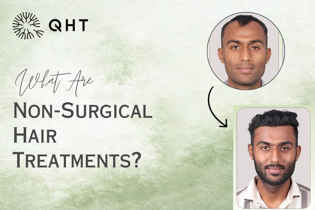 Non-Surgical Hair Regrowth Treatments