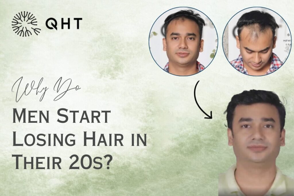 Male pattern baldness treatment