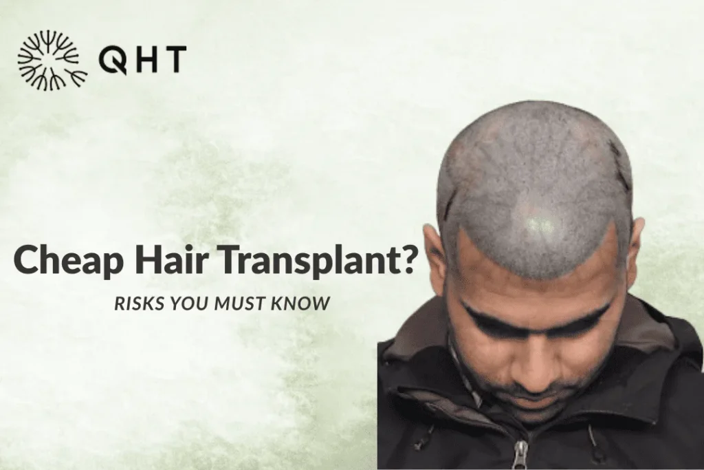 cheap hair transplant
