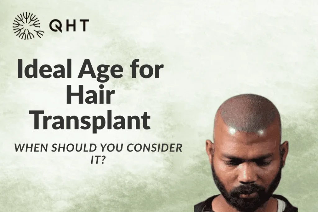 ideal age for hair transplant