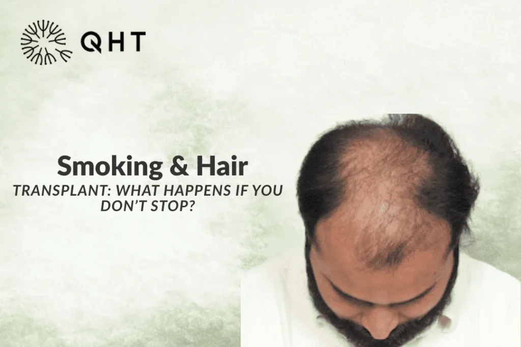 smoking after hair transplant