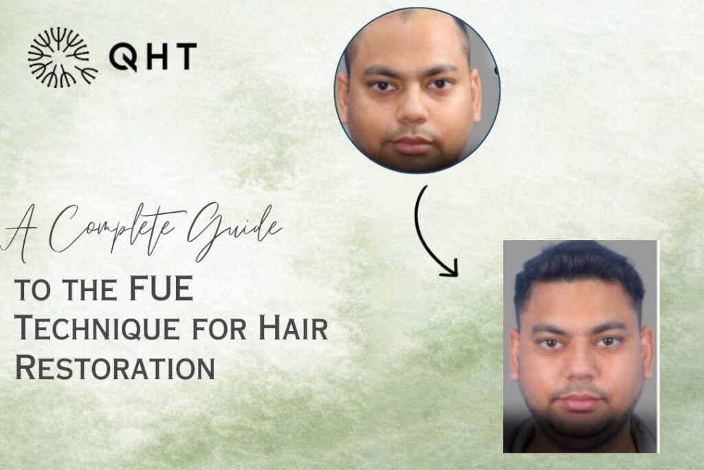 what is a FUE hair transplant