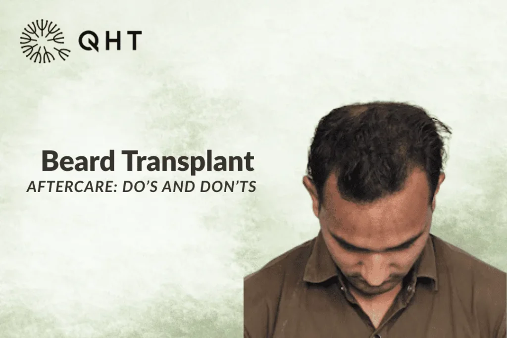 beard transplant aftercare
