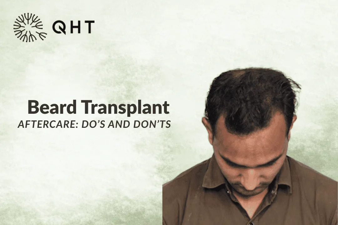 Beard Transplant Aftercare: Do’s and Don’ts