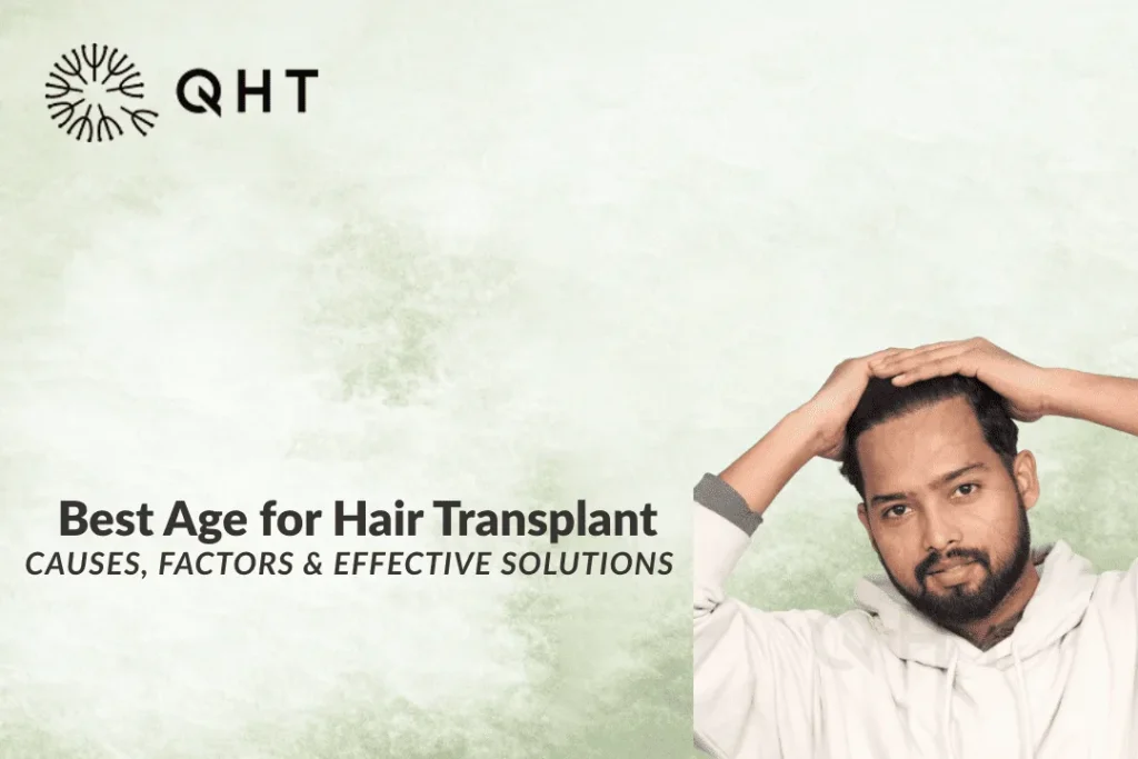 best age for hair transplant
