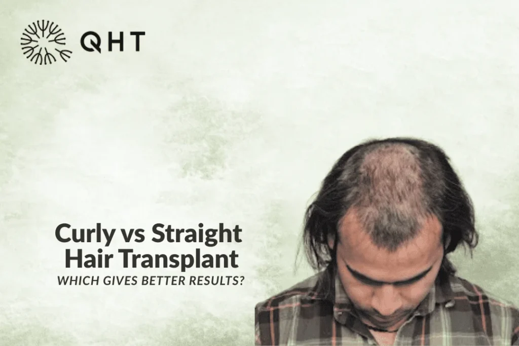 Curly vs Straight Hair Transplant