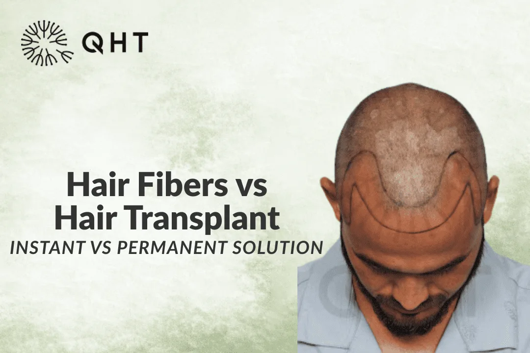 Hair Fibers vs Hair Transplant: Instant vs Permanent Solution
