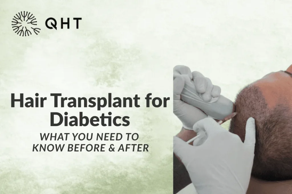 hair transplant diabetes