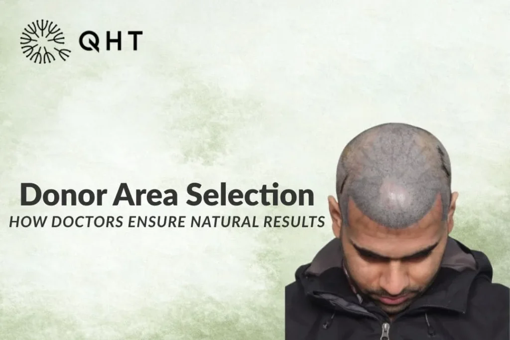 hair transplant donor area