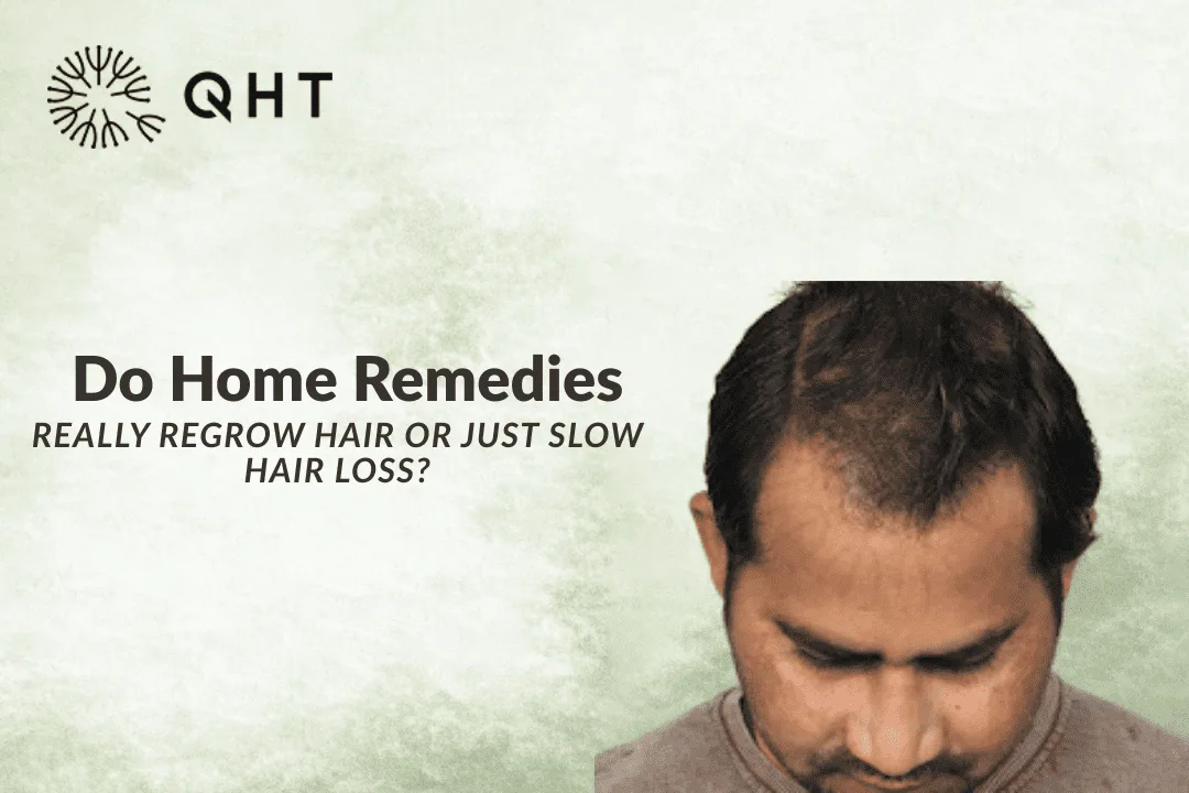 Do Home Remedies Really Regrow Hair or Just Slow Hair Loss?