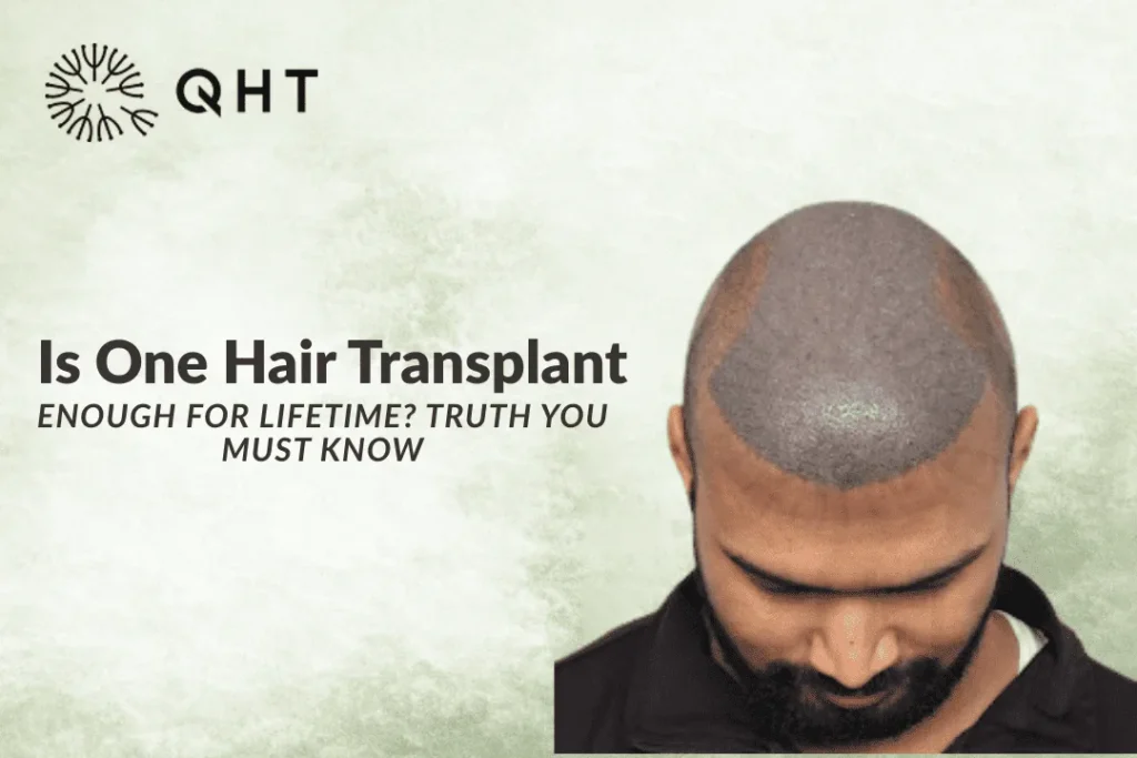one hair transplant enough