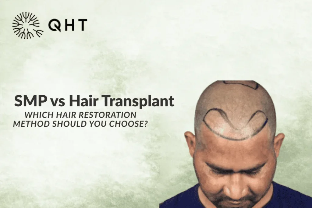 smp vs hair transplant