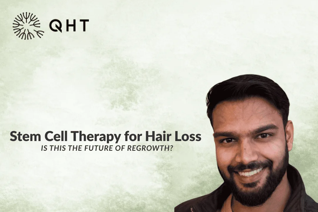 Stem Cell Therapy for Hair Loss: The Future?