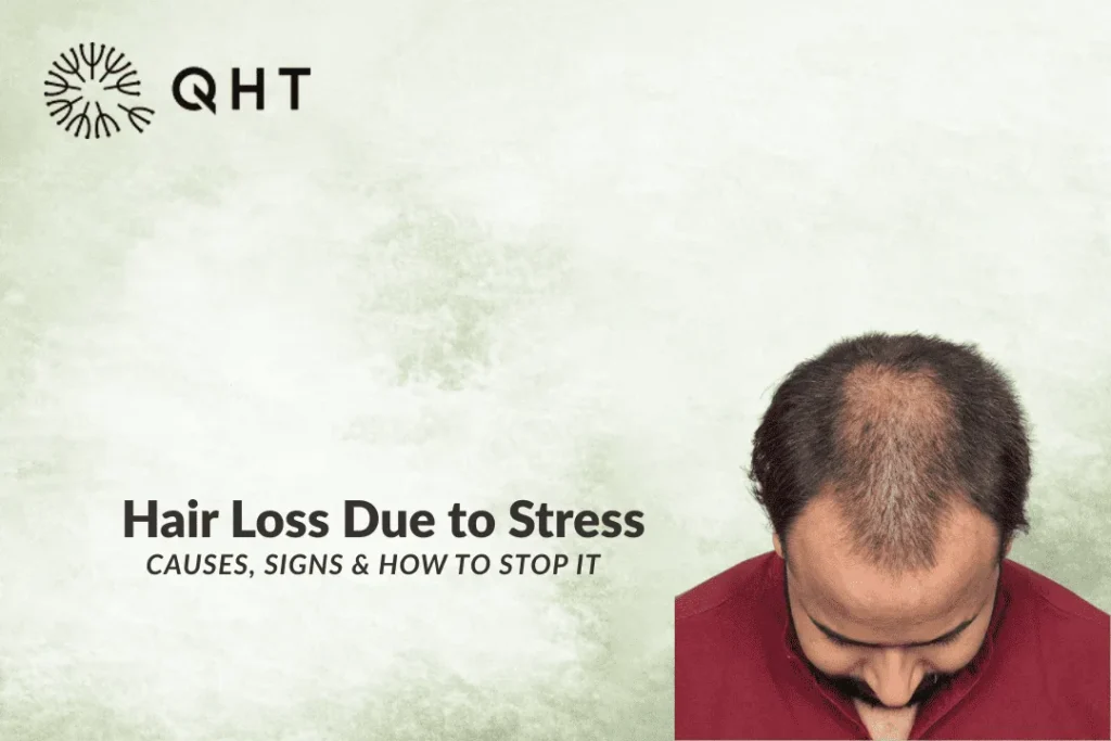 stress hair loss