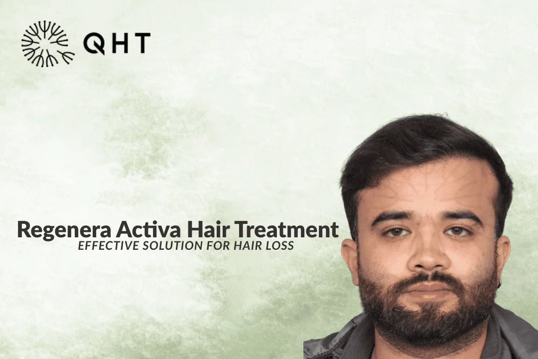 Regenera Activa Hair Loss Treatment – Procedure, Cost and Results