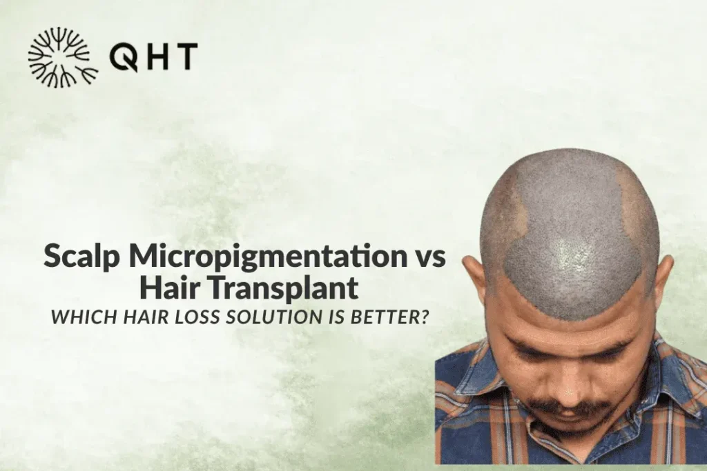 SMP vs hair transplant