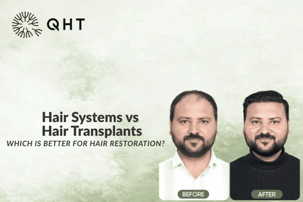hair systems vs hair transplant