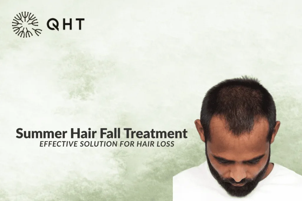 stop hair fall in summer