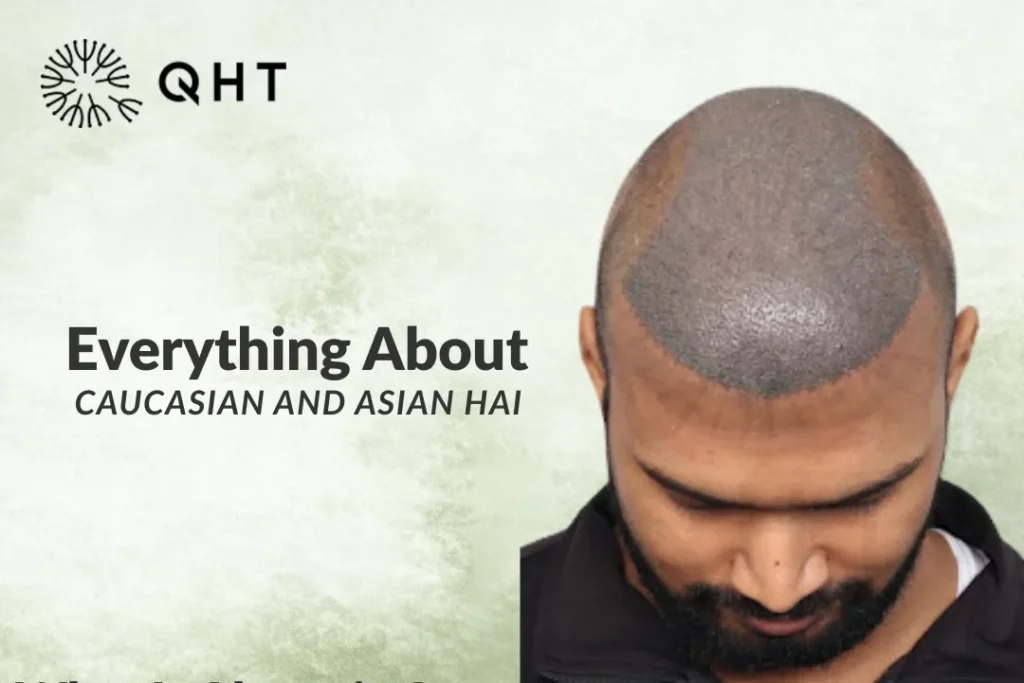Everything About Caucasian And Asian Hair