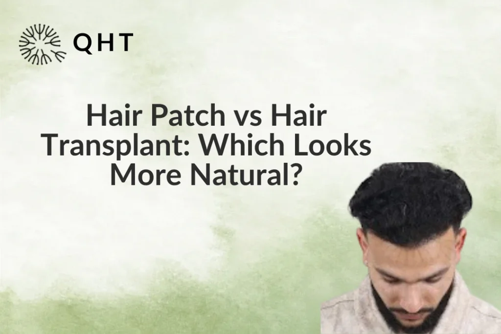 Hair Patch vs Hair Transplant