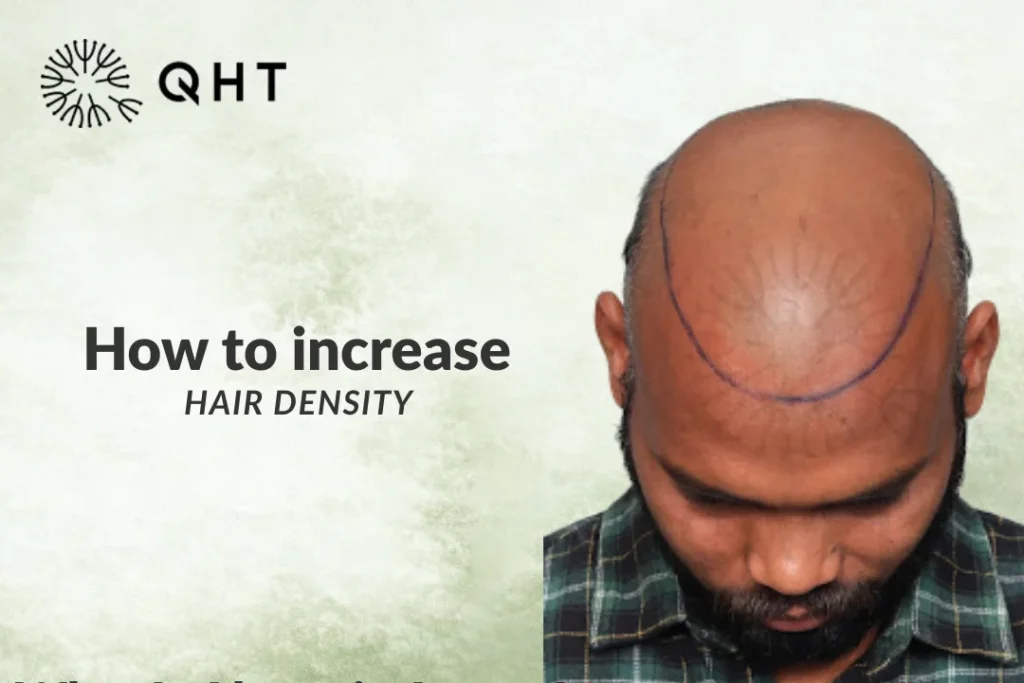 Increase hair volume