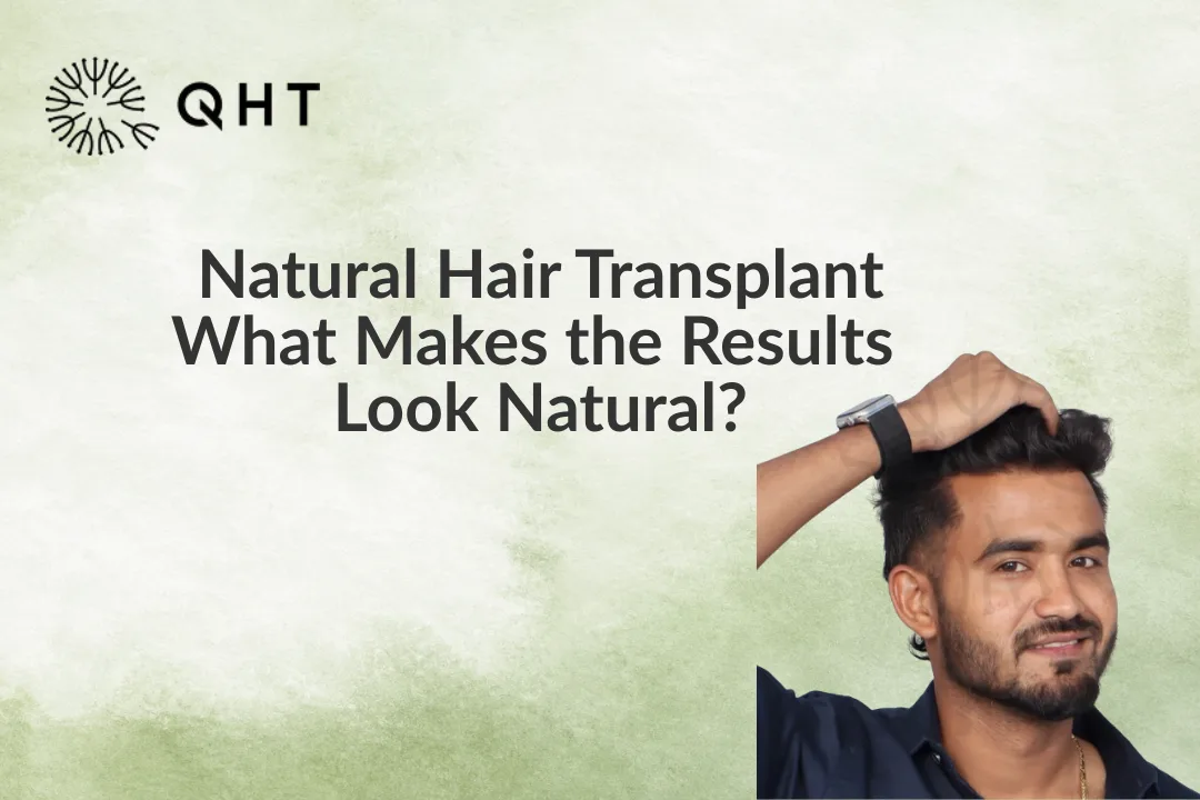 Natural Hair Transplant: What Makes the Results Look Natural?