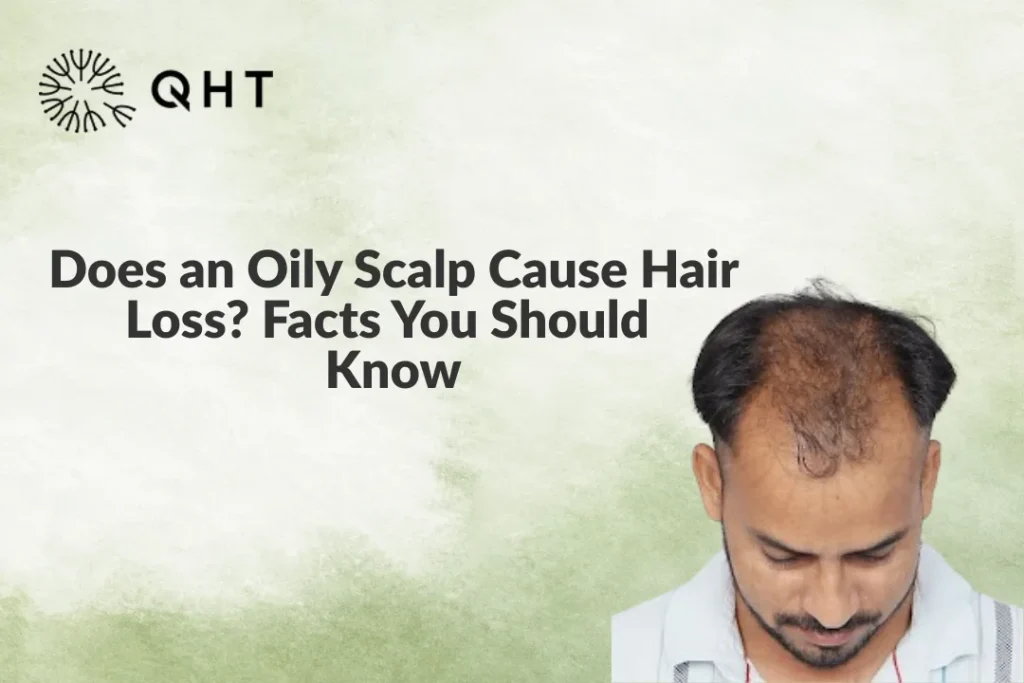 Oily Scalp Hair Loss