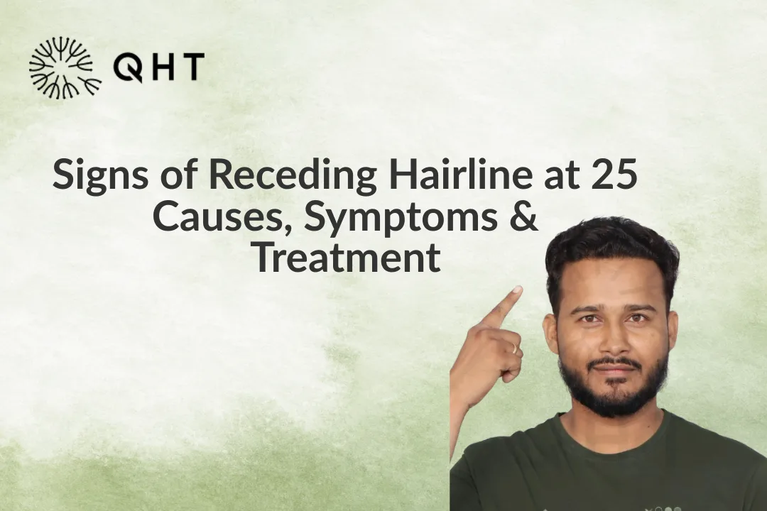 Signs of Receding Hairline at 25