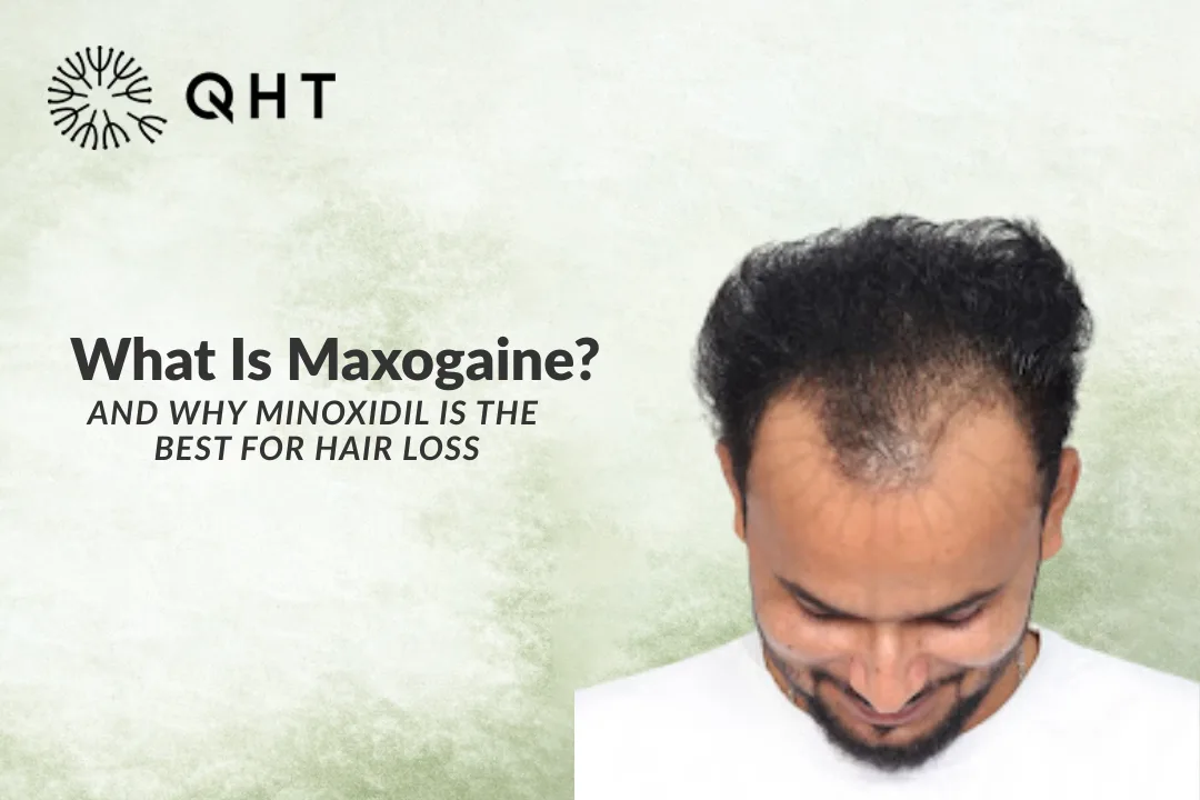 What Is Maxogaine? And Why Minoxidil Is The Best For Hair Loss