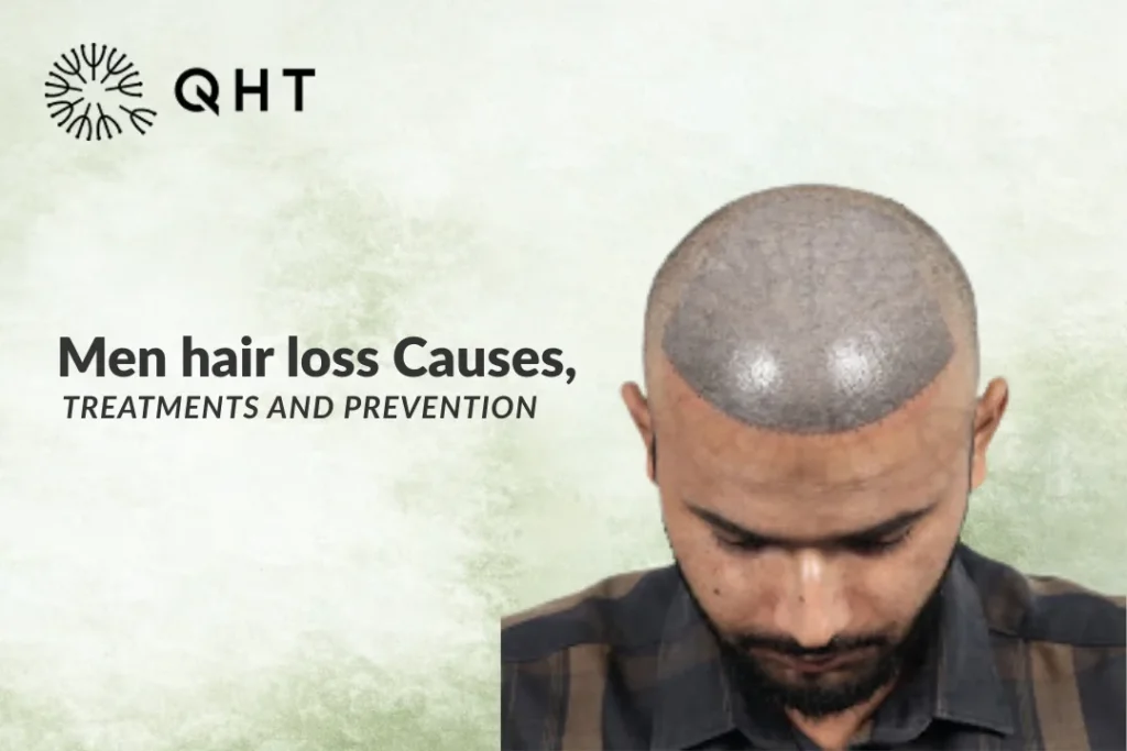causes of hair loss in men