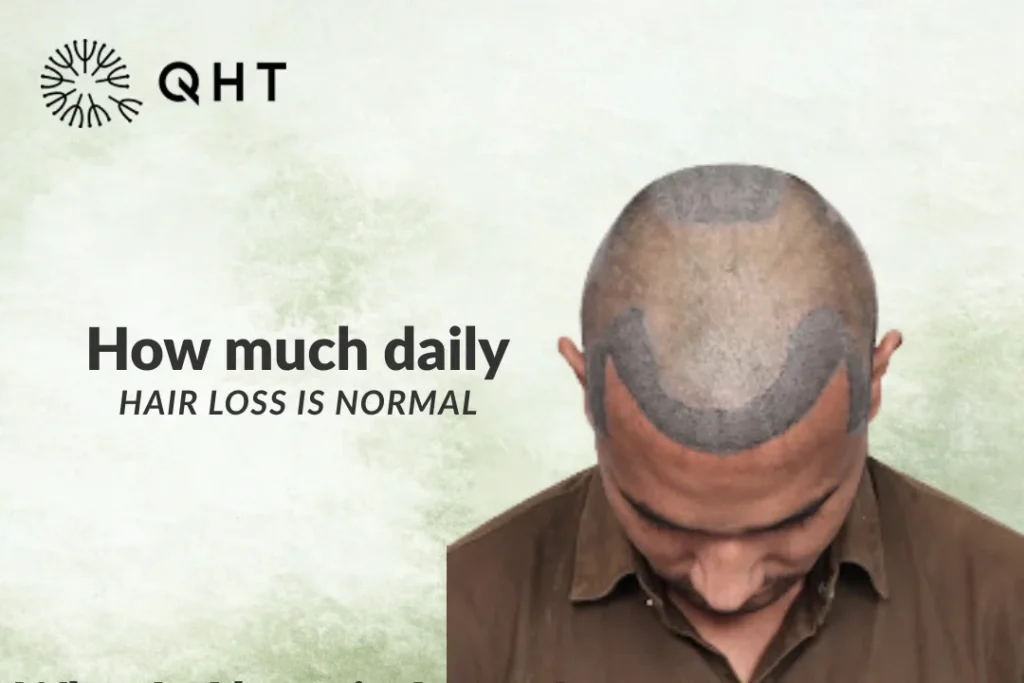 How Much Daily Hair Loss Is Normal?