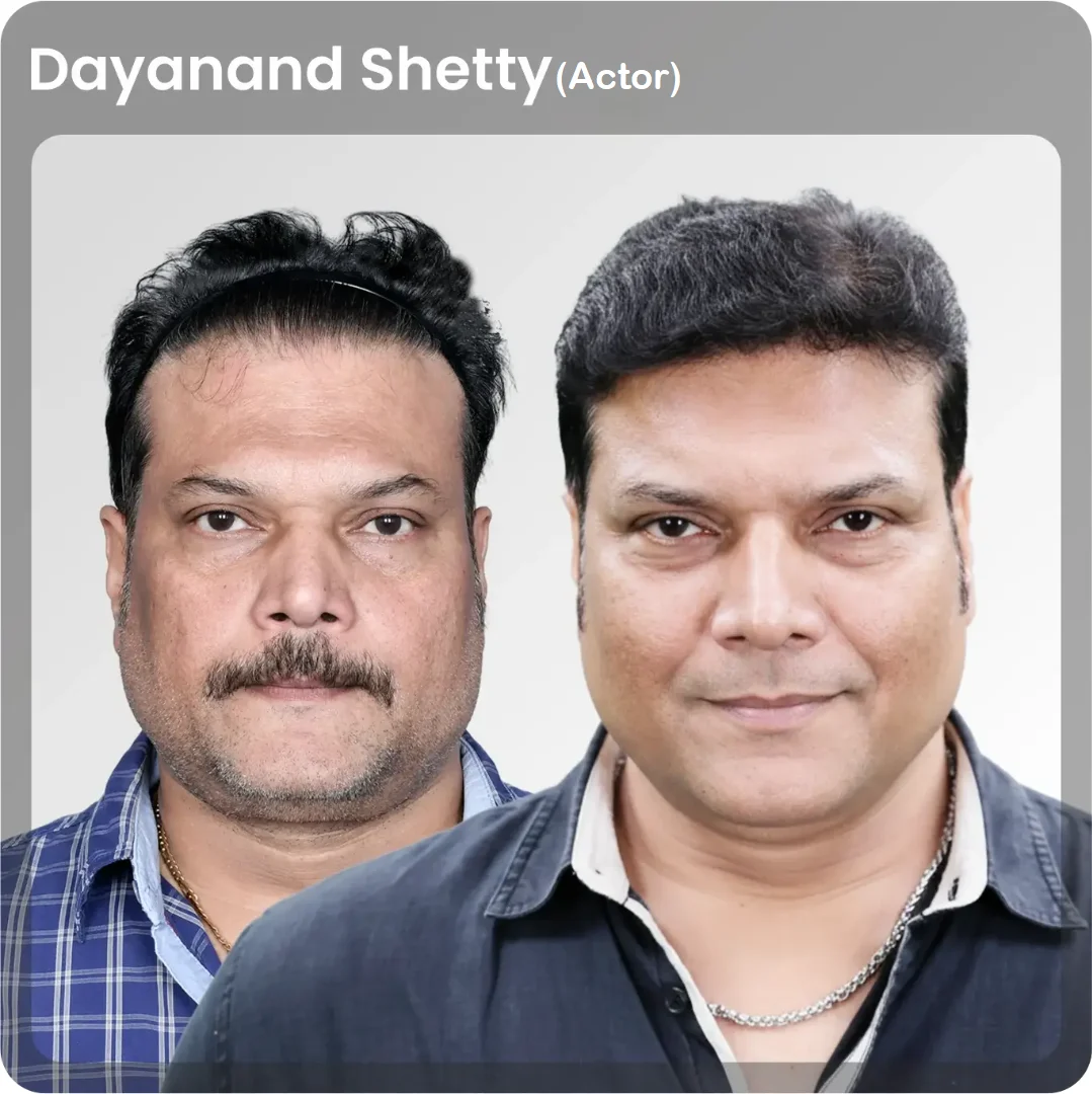 Daya-1